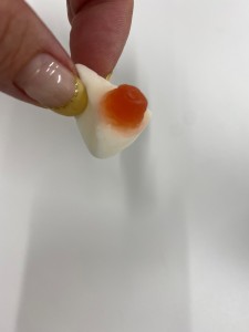 ぐみ